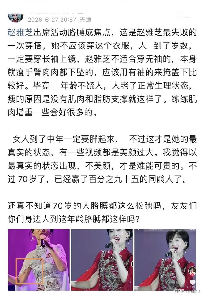 扎心痛啊！70岁赵雅芝舞台无美颜生图曝光，手臂衰老的状态太真实