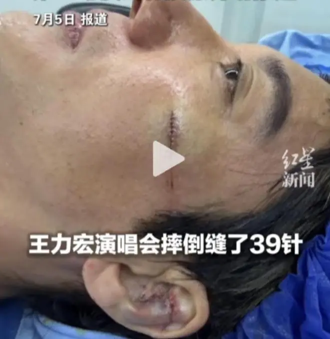 王力宏摔倒细节曝光！出事不是偶然，凶器被故意放脚边，嫌犯被抓