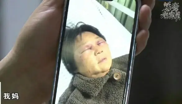 妻子打断婆婆4根肋骨，男子承认妻子多次动手但情有可原：母亲找了新老伴不带娃，要么就给钱补贴；姐姐：母亲苦了一辈子，支持她的决定