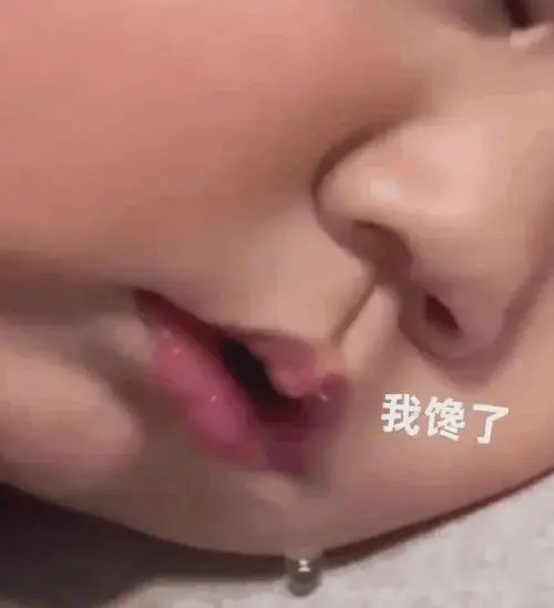 连吃两顿，深圳一女子突然变“社牛”！逢人就打招呼，手舞足蹈，医生：中毒导致幻觉