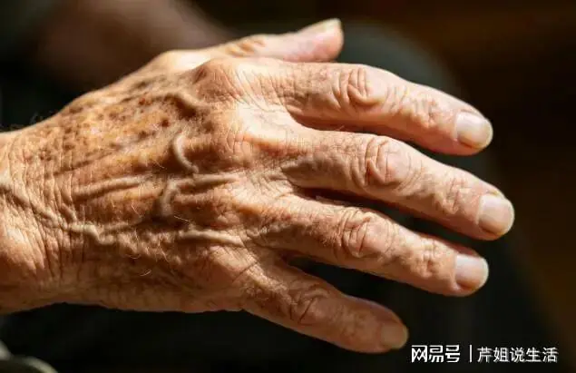 手背藏着长寿信号！有这4种表现，说明身体底子好，快自查